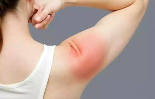 دلایل پارگی تاندون شانه چیست؟ + ویدئو