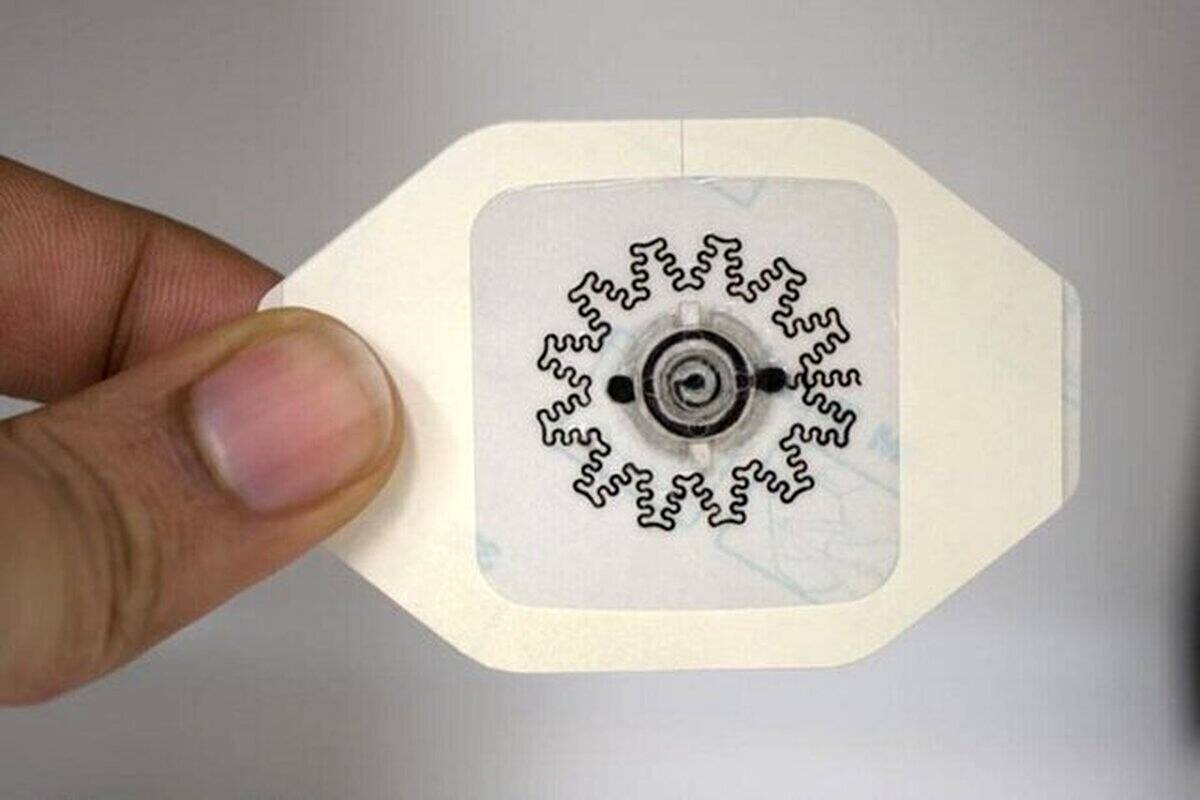 اختراع یک پانسمان جدید که درمان زخم را متحول میکند