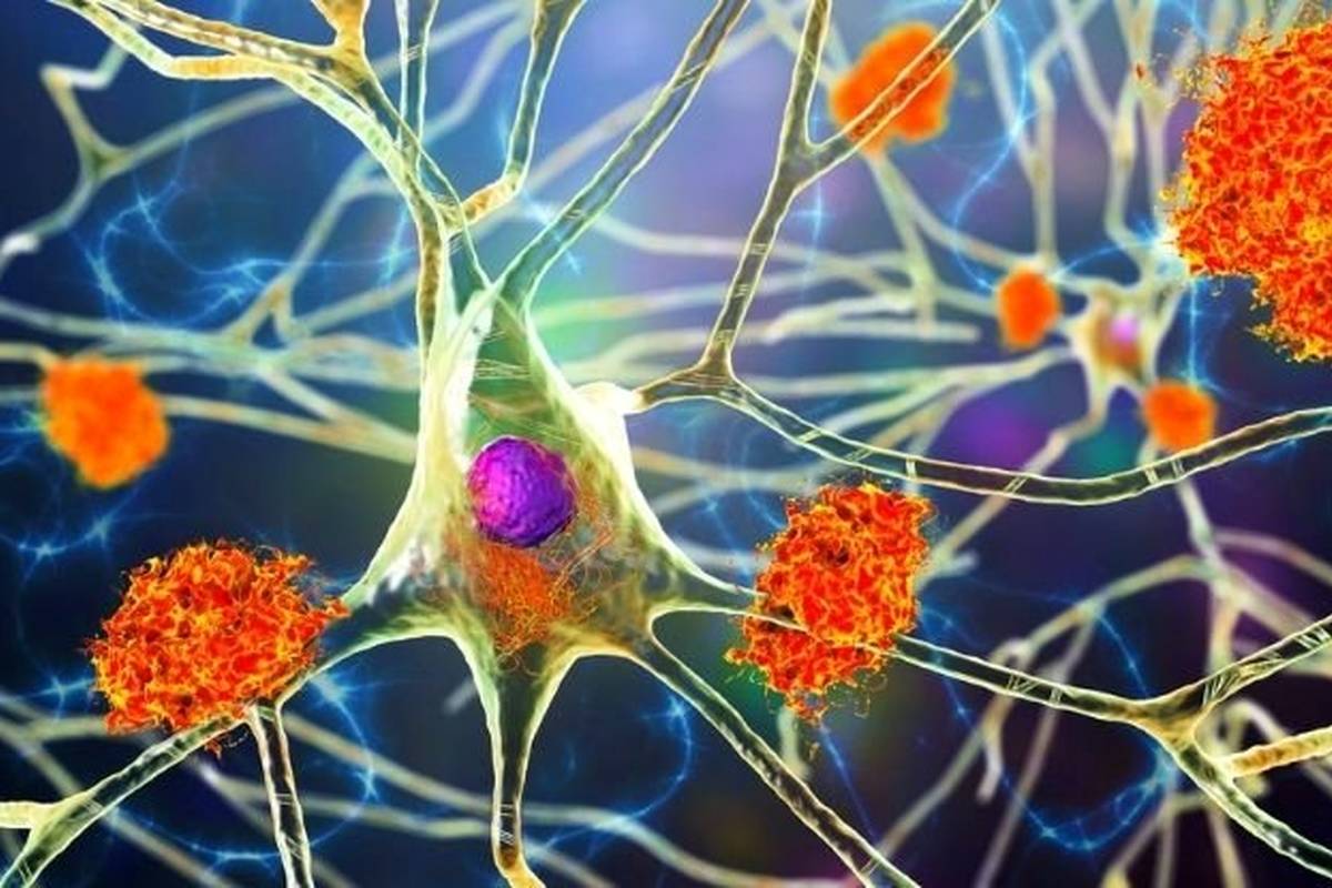 آلزایمر و پارکینسون را هم ویروسها ایجاد میکنند!