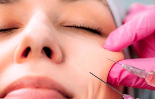 هشدار وزارت بهداشت درباره تزریق ژل | ژل‌های استاندارد چه ویژگی‌هایی دارند؟