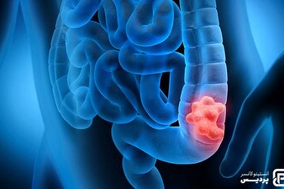 با دیدن این نشانهها به پزشک مراجعه کنید، ممکن است سرطان باشد