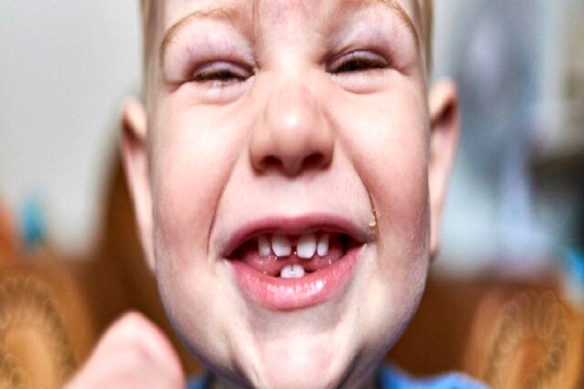چرا قلقلک باعث خنده میشود؟