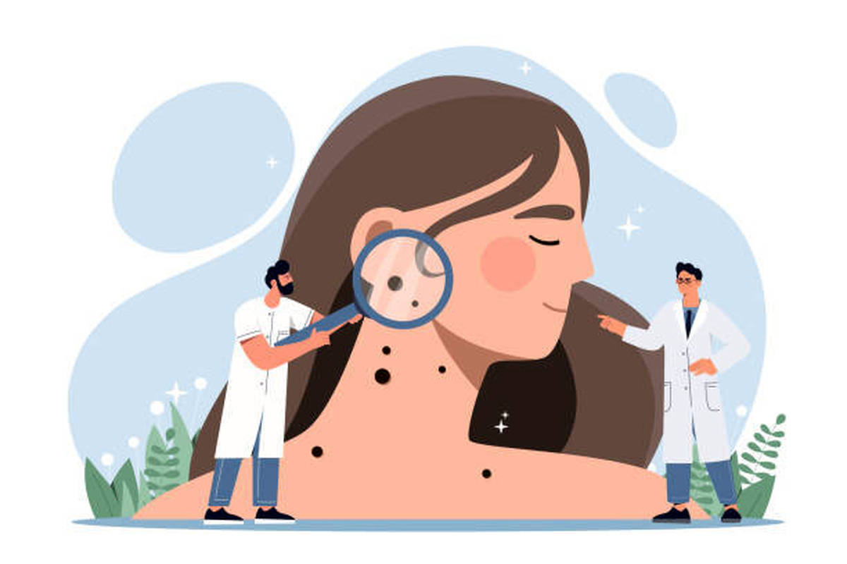 دستور تهیه ماسک‌های بی‌نظیر برای صورت/ کلاژن‌ساز و رطوبت‌بخش/ نظرات یک متخصص طب سنتی