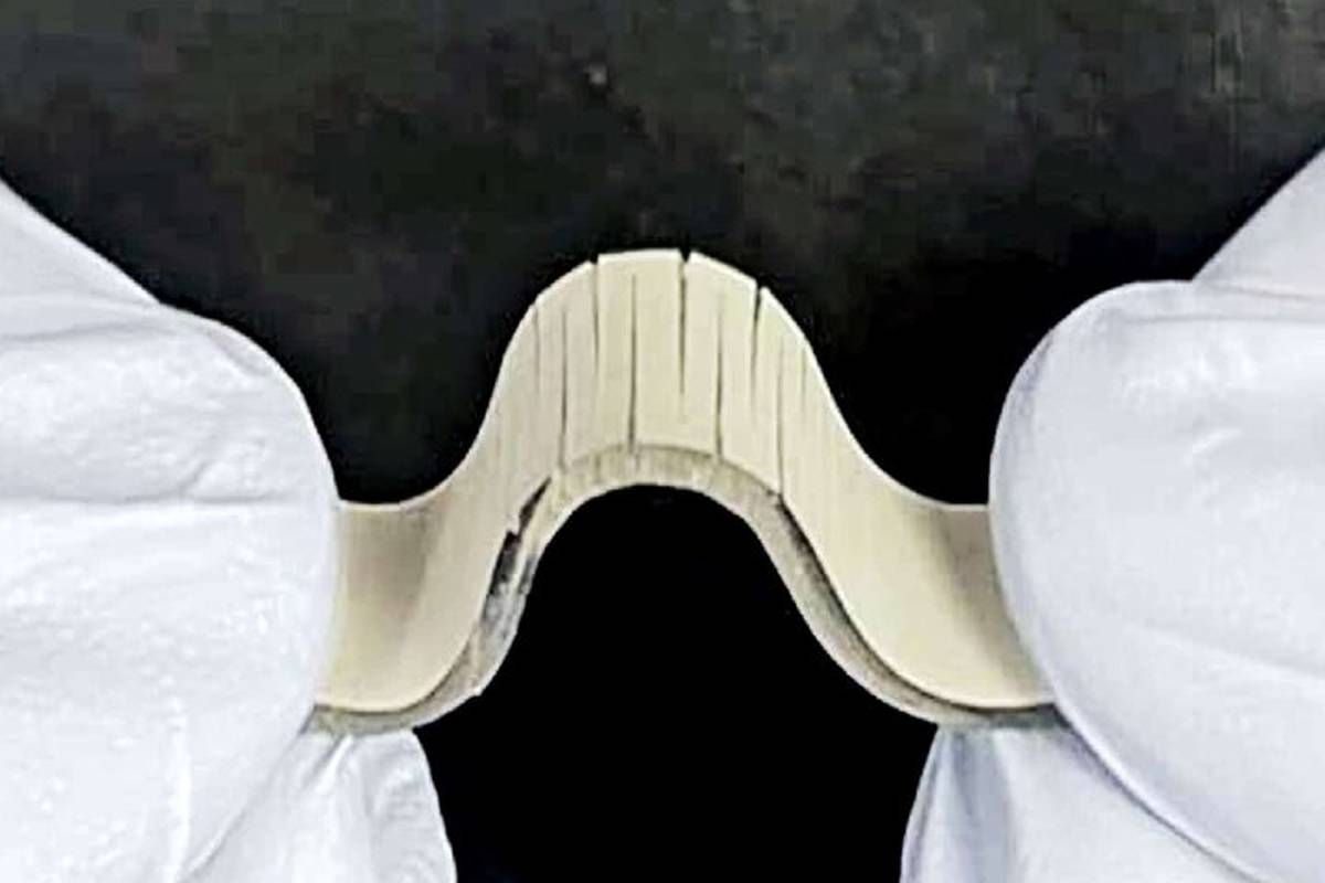 حسگر جدیدی که سکته مغزی را تشخیص میدهد