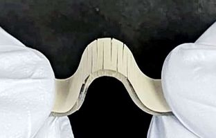 حسگر جدیدی که سکته مغزی را تشخیص می‌دهد