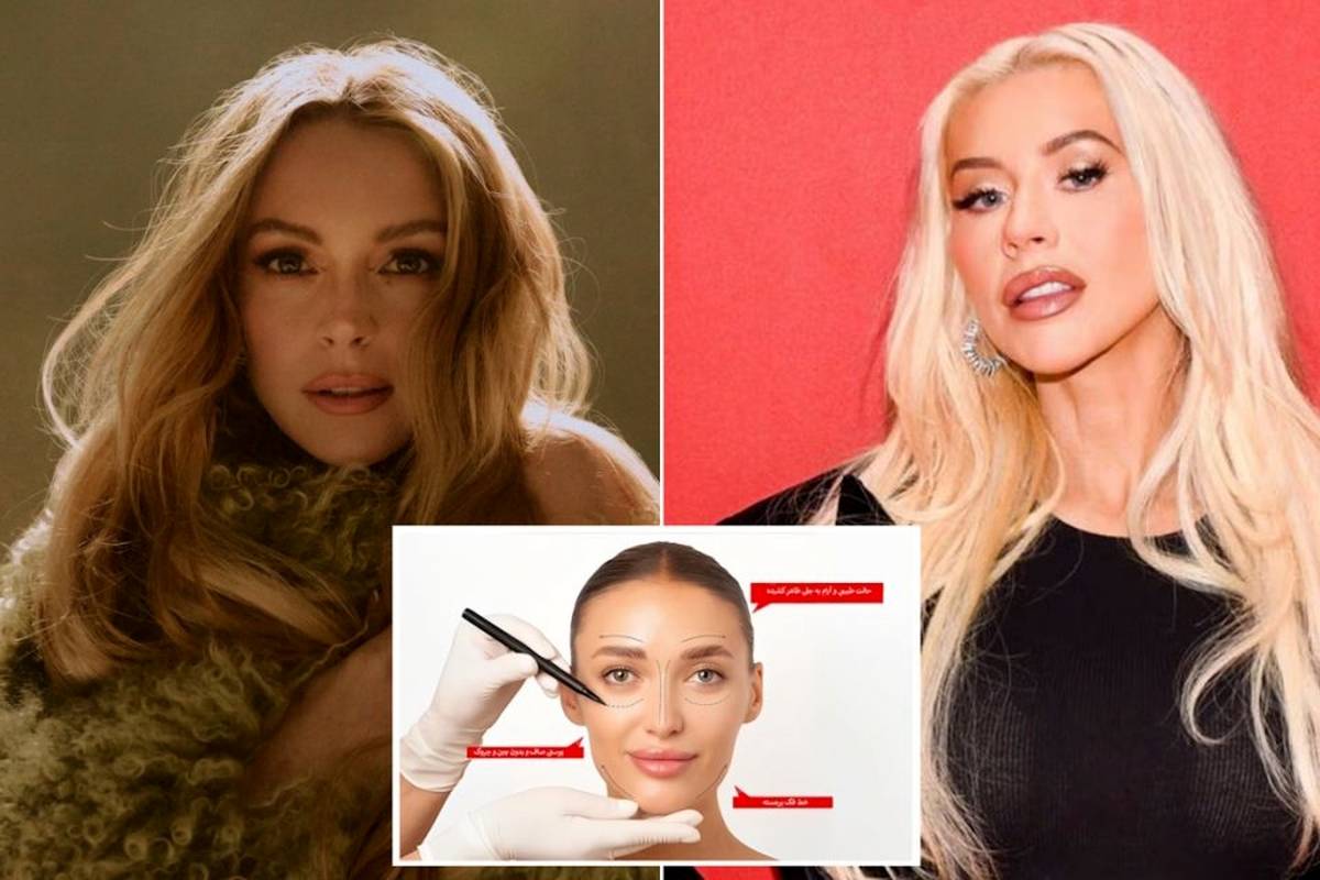 پرتقاضاترین جراحیهای پلاستیک صورت در سال ۲۰۲۴ و تاثیر غیرقابلانکار سلبریتیها