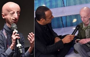 مسن‌ ترین بازمانده بیماری نادر «بنجامین باتن» در سن ۲۸ سالگی درگذشت