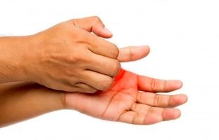 خارش کف دست، خبر از پول می‌دهد یا بیماری؟