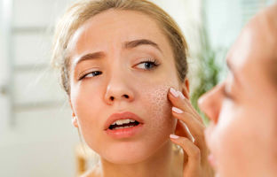 بهترین کرم آبرسان برای رهایی از خشکی پوست در فصل سرما