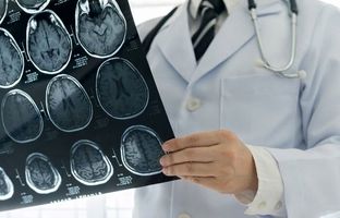 لحظه تلخ سکته پزشک مشهدی در حین طبابت + ویدئو