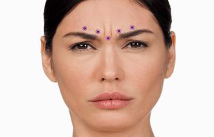 با خط اخم پیشانی خداحافظی کن! خیلی ارزان و ساده!