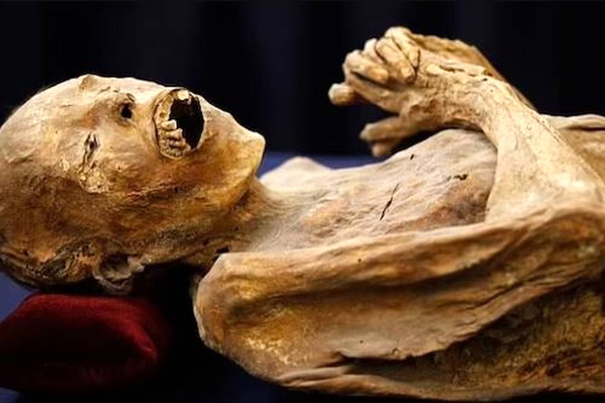 آیا جذام، سل و آبله از مومیاییهای مصری قابل انتقال است؟