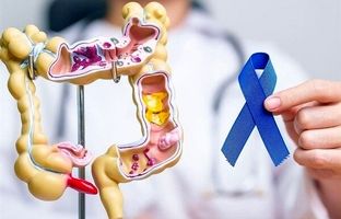 کدام افراد در معرض خطر سرطان روده هستند؟
