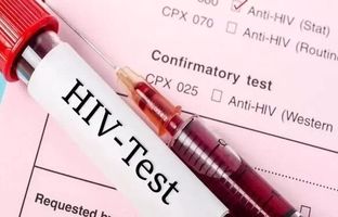 تعداد بیماران مبتلا به ایدز در کشور اعلام شد ؛ تفاوت قابل توجه تعداد مردان و زنان مبتلا به HIV (اچ‌آی‌وی)