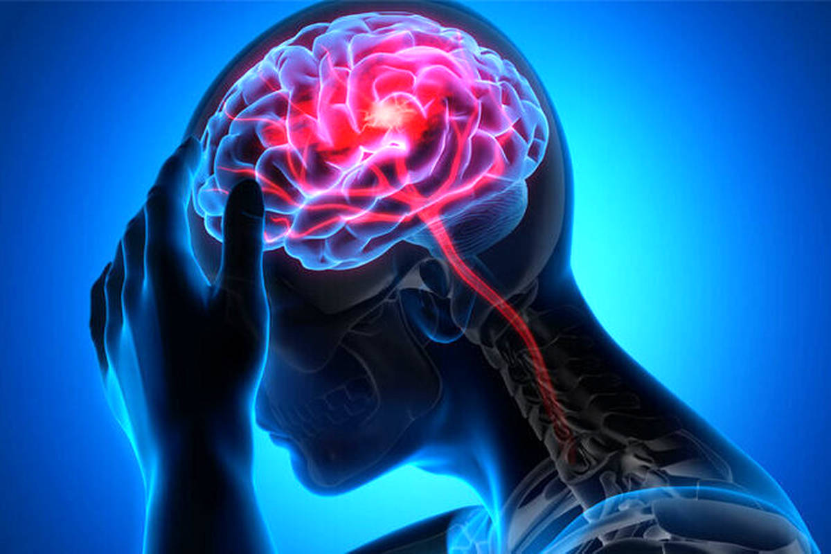 سبک زندگی ما چقدر روی سلامت مغز اثر دارد؟/ ۷ عادات ساده که مغزتان را نابود میکنند