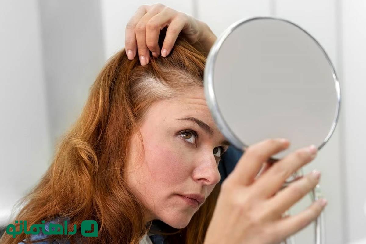 از ریزش مو خسته شدی؟ این 5 ماسک مو رو امتحان کن!