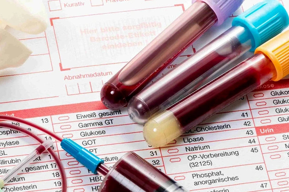 با یک آزمایش خون بفهمید چقدر تا مرگ فاصله دارید