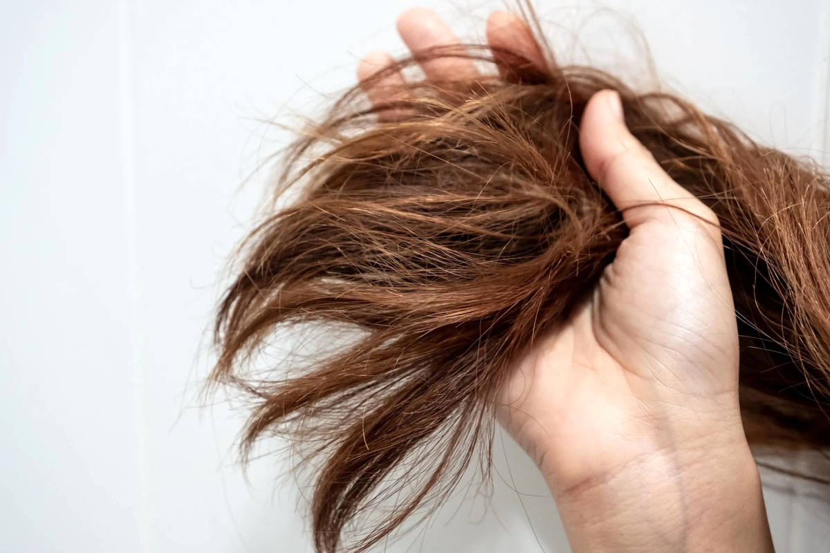 موخوره چیست؟ / راههای پیشگیری و درمان قطعی آسیب موها