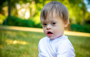 دستاورد ابزار ویرایش ژن: حذف کروموزوم اضافی عامل سندرم داون در سلول‌های انسانی