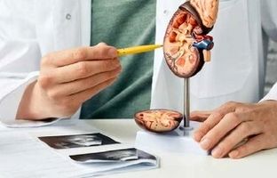 ارتباط بین سنگ کلیه و دیابت/ قند خون بالا باعث سنگ کلیه می‌شود؟