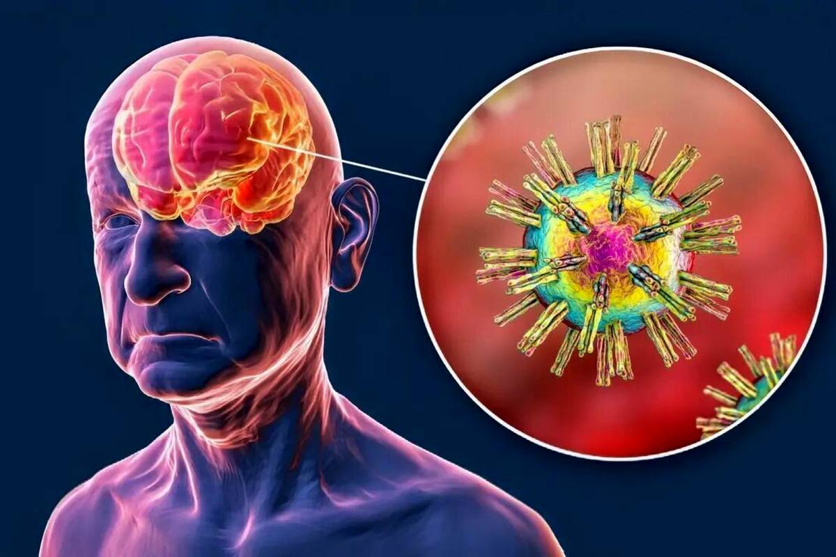ضربه به سر، ویروسهای خفته مغز را بیدار میکند