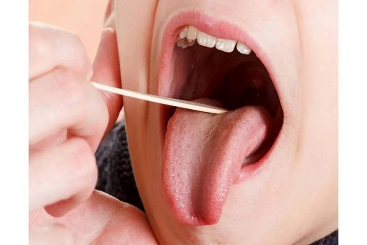 از روی زبان کمبود ویتامین دی را تشخیص دهید!