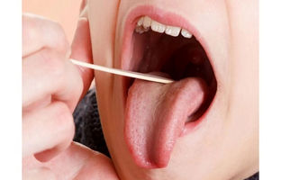  از روی زبان کمبود ویتامین دی را تشخیص دهید! 