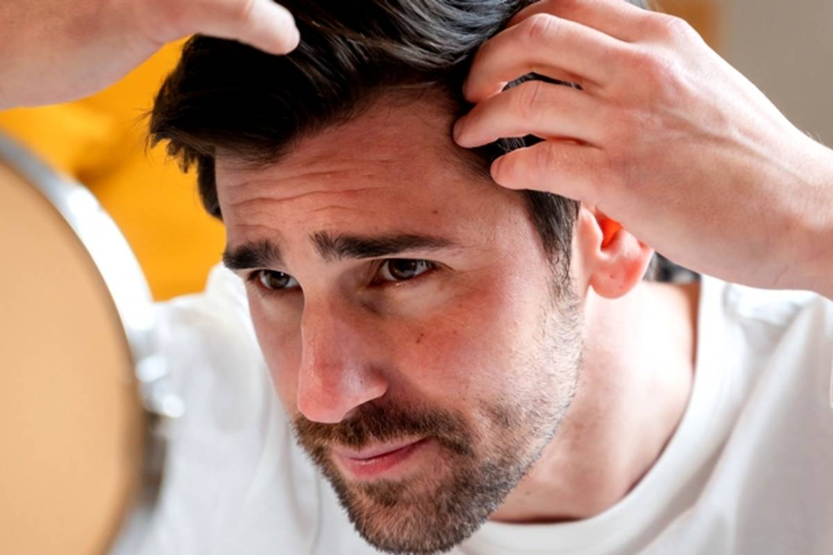 موی بلوند هم سفید میشود؟ + آیا مو یک شبه سفید میشود؟