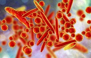 ذات‌الریه «مایکوپلاسما» چیست؟